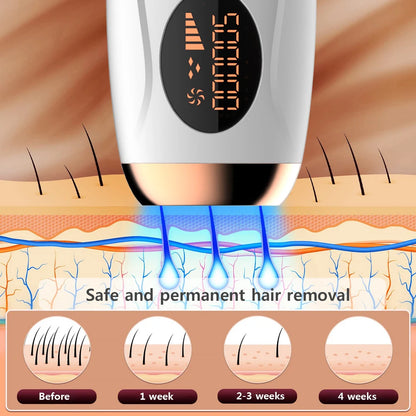 Permanent Hair Removal for Women’s Body and Bikini Line